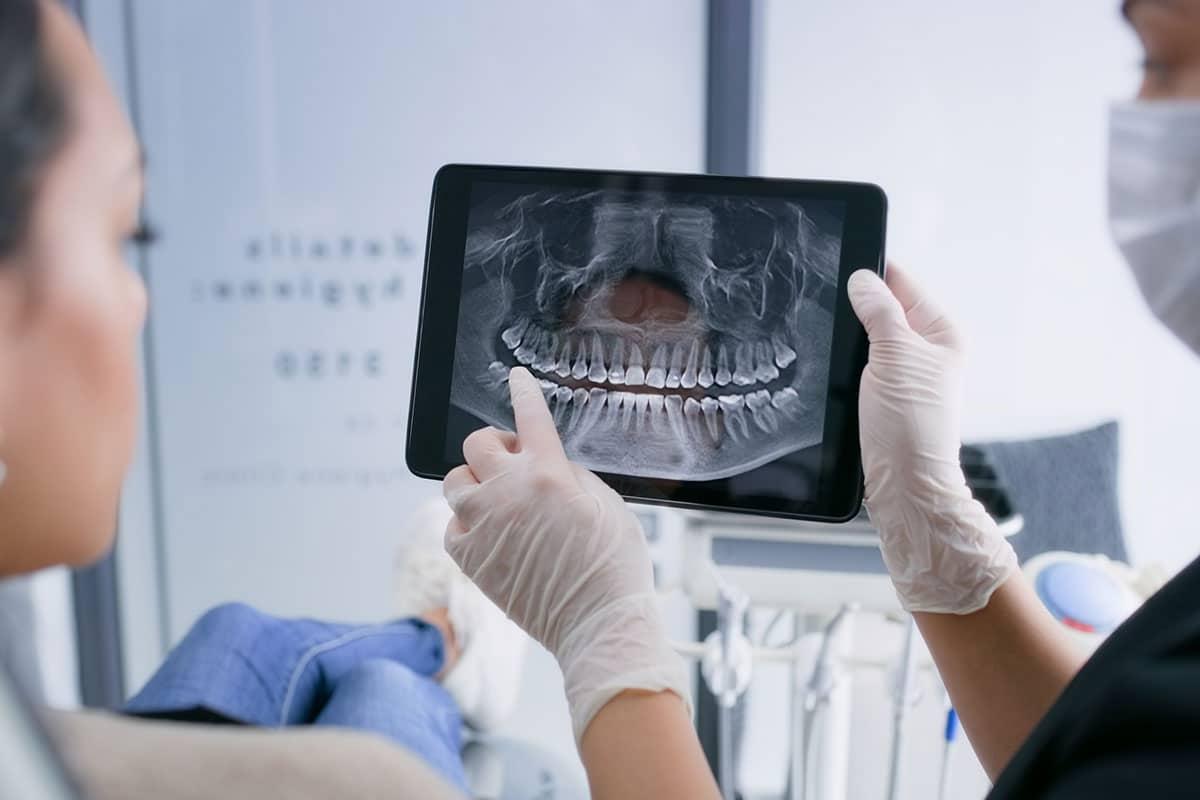 Modern Digital Dental X-Rays for Accurate Diagnosis